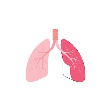 Emphysema Lung Disease Concept Design. Vector Illustration.