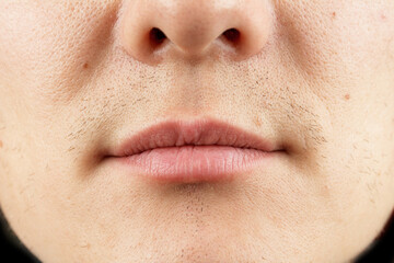 The lower third of a man's face nasolabial folds the structure of the lips of the nose a person's face close-up