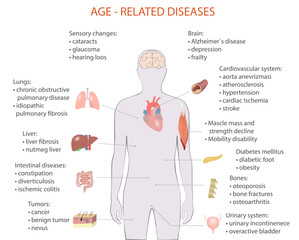 vector illustration of age-related diseases