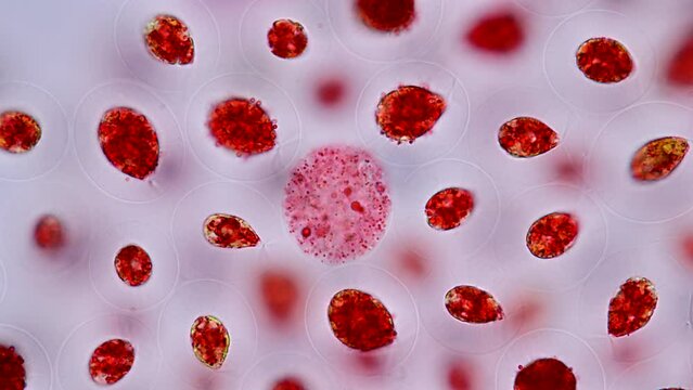 Algae containing massive amounts of Astaxanthin making it red under the microscope 