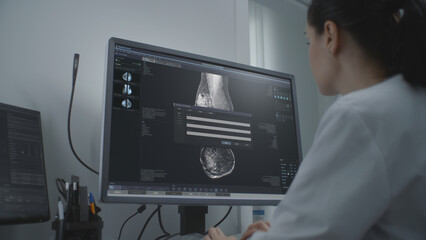 Professional female doctor examines results of mammography screening procedure using computer....