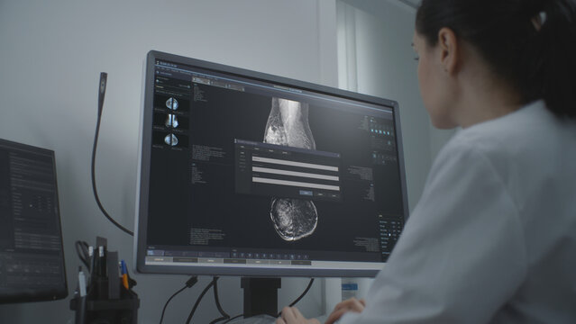 Professional female doctor examines results of mammography screening procedure using computer. Mammogram scans of breast tissues displayed on PC screen. Breast cancer prevention. Hospital or clinic.