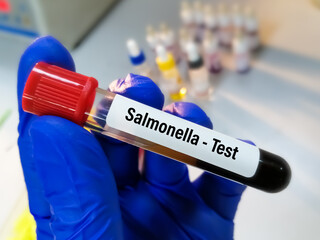 Blood sample for Salmonella bacteria test, Typhoid fever test