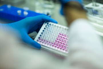 cell culture at the medicine, medical and biology laboratory, cancer science experiment at the...