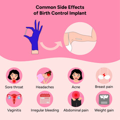 Common side effects of birth control implant, medical information and illustration - obrazy, fototapety, plakaty