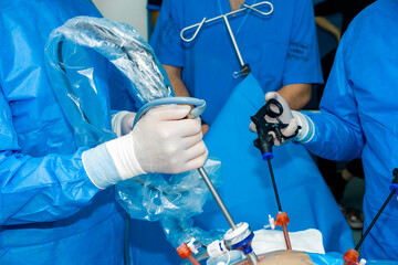 The hands of a surgeon in sterile gloves operate with laparoscopic surgical instruments. Selective focus. Surgeons perform minimally invasive laparoscopic surgery.