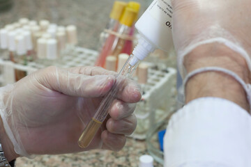 Biochemist adding a reagent to a test tube