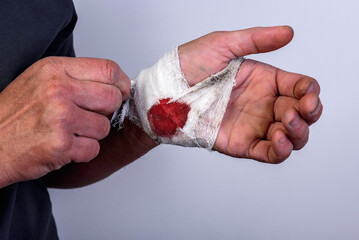 A woman holds a dirty bandaged hand with a bloodstain on a gray background.