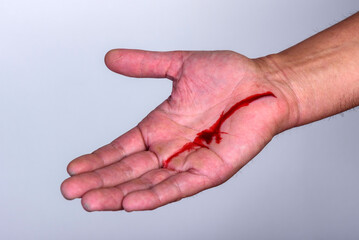 Injured hand with bleeding open cut on a gray background.