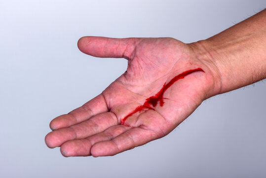 Injured hand with bleeding open cut on a gray background.