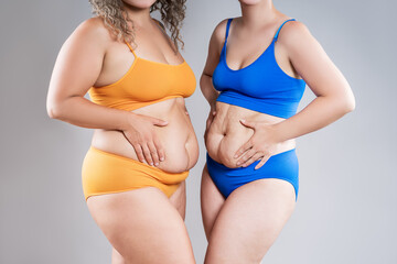 Tummy tuck, two fat women with flabby bellies on gray background, plastic surgery and body positive concept
