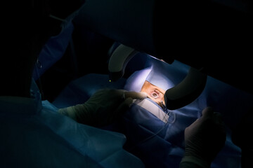 laser vision correction. Medical laser eye correction. Medicine technology eye operation. - obrazy, fototapety, plakaty