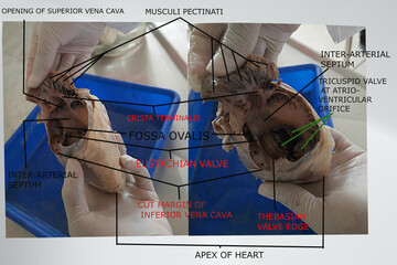 anatomical features of the interior of the right atrium