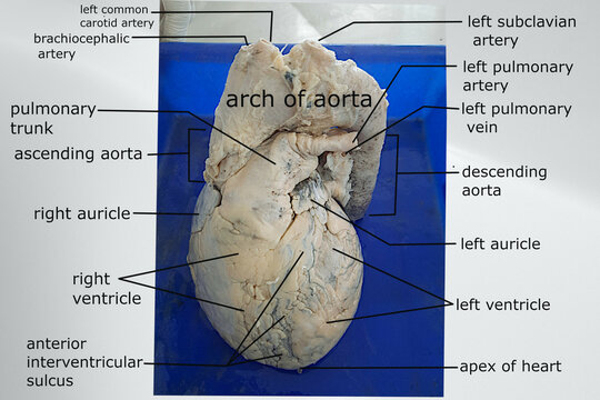 anatomical features of anterior view of human heart with attached great vessels 