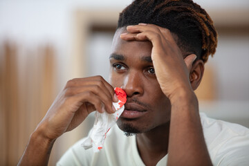 young man is holding tissue to his bleeding nose - obrazy, fototapety, plakaty