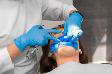 Process of installing a dental cofferdam on the jaw of a young woman wearing protective glasses for...