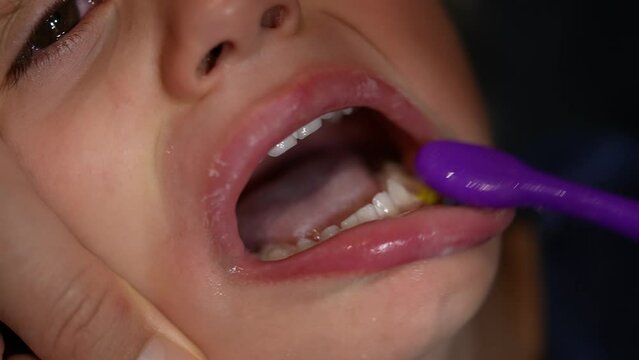 Brushing child teeth. Tearful kid while parent brushes mouth. Night bedtime routine for little boy. Macro closeup of tooth being cleaned
