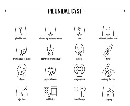 Pilonidal Cyst symptoms, diagnostic and treatment vector icons. Line editable medical icons.