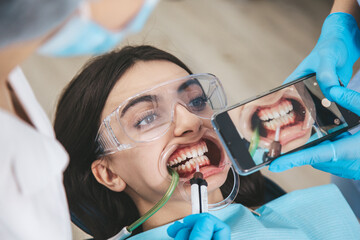 Patient in a dental chair with an open mouth receives treatment from the dentist while an assistant captures the process on a smartphone - obrazy, fototapety, plakaty