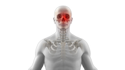 Human skeleton with orbital face fracture - obrazy, fototapety, plakaty