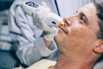 Skin doctor using laser resurfacing facial skincare treatment technology with adult male to reduce...