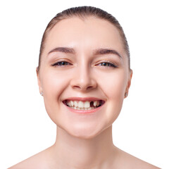 Woman teeth with hole. Dental implant concept.