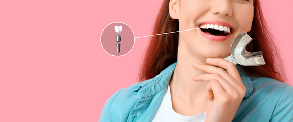 Young woman with implanted tooth and dental tool on pink background, closeup