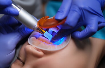 Doctor dentist illuminating filling with modern light lamp in clinic closeup. Modern methods of caries treatment concept