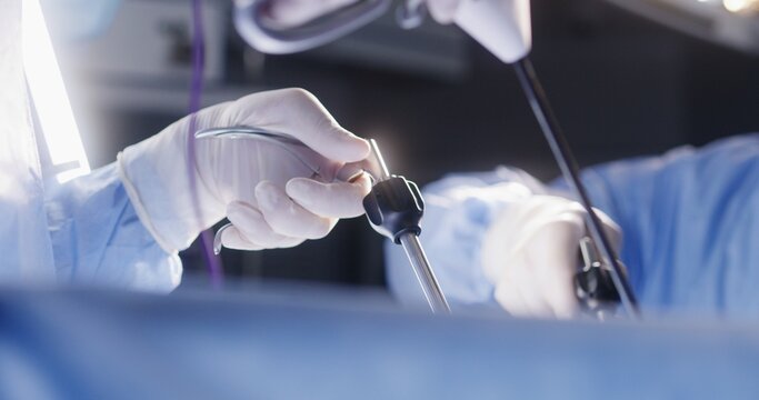 Hands close up of professional surgeons performing operation using laparoscopic tools. Medical staff together save seriously injured patient in surgery room. Medics work in modern medical facility.