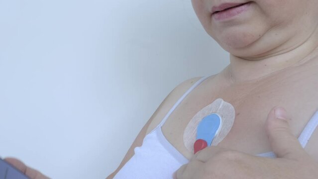 sensors on chest for Holter monitoring, woman with Holter monitor daily monitoring of electrocardiogram, blood pressure, cardiac examination, treatment of cardiac diseases, track pacemaker dysfunction
