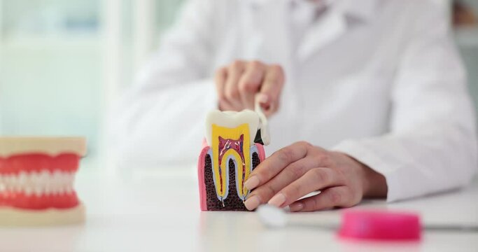 Dentist cleans artificial model of tooth with toothbrush in examination room. Doctor practitioner demonstrates right care for teeth in clinic slow motion