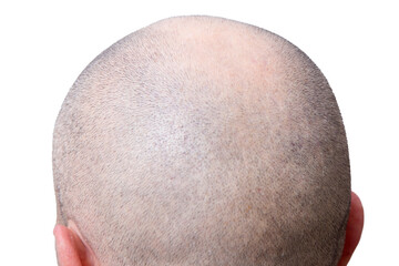 closeup of the head shaved without hair