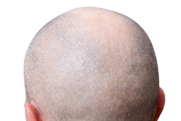 closeup of the head shaved without hair