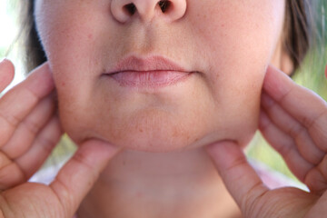 Double chin face mature woman 50 years old, human fat neck, sagging cheeks, wrinkles on skin,...