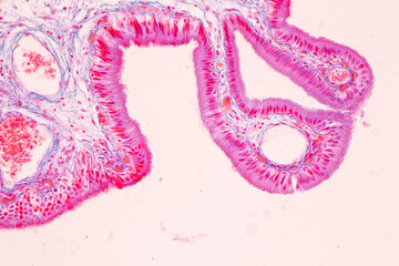 Histological Rectum human, Gall bladder human and Urethra Human under the microscope for education.