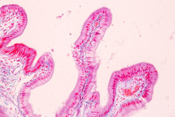 Histological Rectum human, Gall bladder human and Urethra Human under the microscope for education.