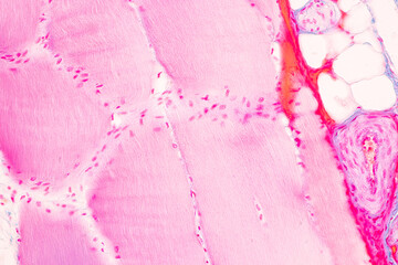 Histological Rectum human, Gall bladder human and Urethra Human under the microscope for education.