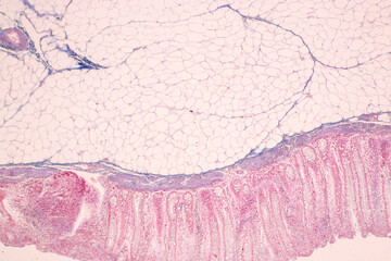 Fototapeta premium Histological Rectum human, Gall bladder human and Urethra Human under the microscope for education.
