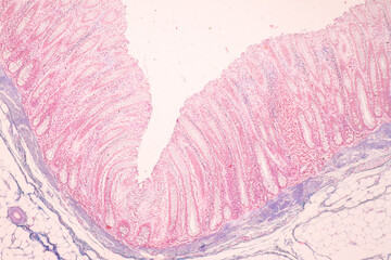 Histological Rectum human, Gall bladder human and Urethra Human under the microscope for education. - obrazy, fototapety, plakaty