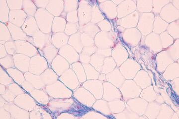 Histological Rectum human, Gall bladder human and Urethra Human under the microscope for education.