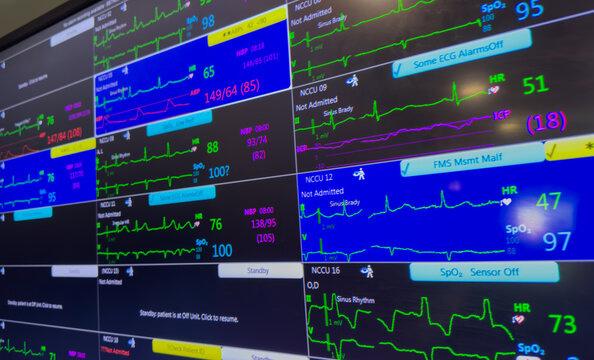 Medical monitor displays vital signs with graphs and numbers, heart rate, blood pressure, temperature, conveying health data, technology, healthcare, and patient monitoring concepts