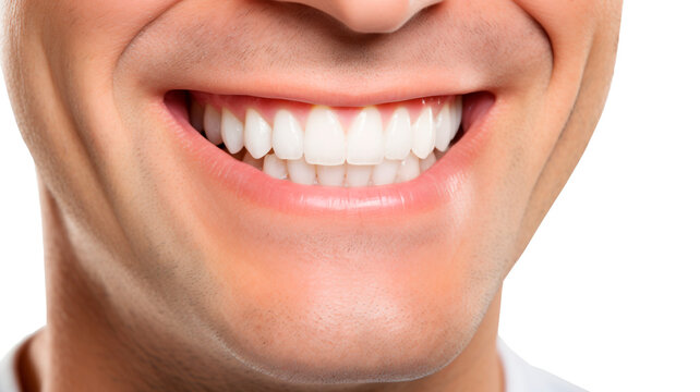 a close-up photograph of a smiling man with perfect white teeth, showing the health of his teeth . Generative AI