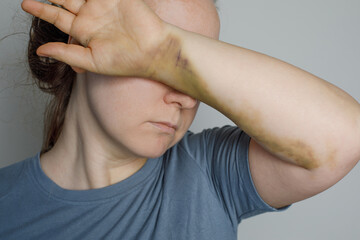 Stop abuse concept, stop violence against women