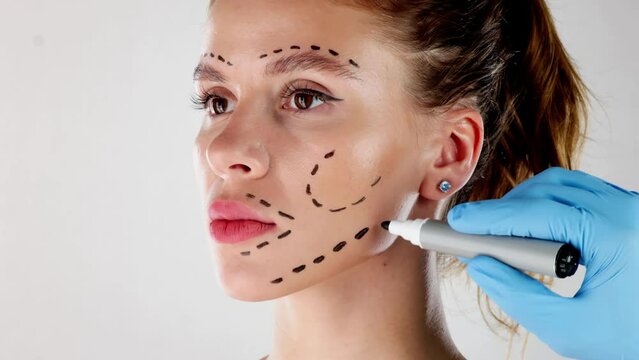 Facial Aesthetics Facelift. Plastic Surgery Drawings