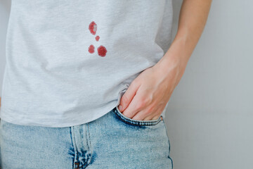 Drops stain of blood on a light t-shirt. daily life stain concept. 