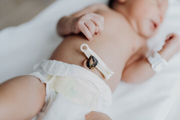 newborn with a clamped umbilical cord