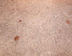 Birthmarks on a man's bald head. Macro