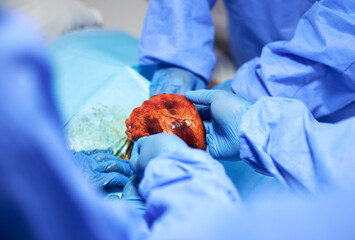 Organ transplant, surgery and doctors with heart in hospital for medical service, procedure and...