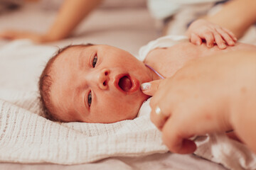 The examination of newborn baby mouth, frenulum of the tongue - obrazy, fototapety, plakaty