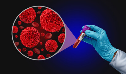 Blood Cancer screening Test as an Oncology medical diagnosis for tumor markers as a liquid biopsy for early detection with malignant cells to diagnose cancers - obrazy, fototapety, plakaty